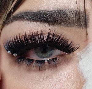 کاشت مژه هیدن (نامرئی)