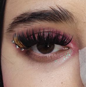 کاشت مژه هیدن (نامرئی)